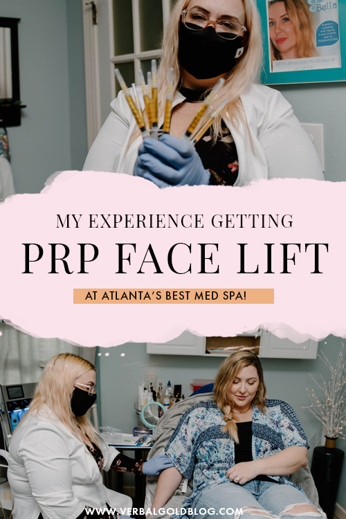 What is a PRP Facelift? My Experience Getting PRP Injections In Atlanta